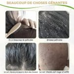 Peigne-Anti-Poux-en-Acier-Inoxydable-a-Pointes-Arrondies-technique-4596