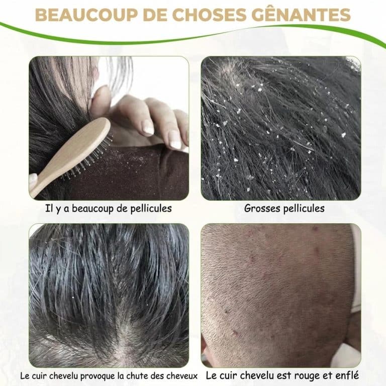 Peigne-Anti-Poux-en-Acier-Inoxydable-a-Pointes-Arrondies-technique-4596